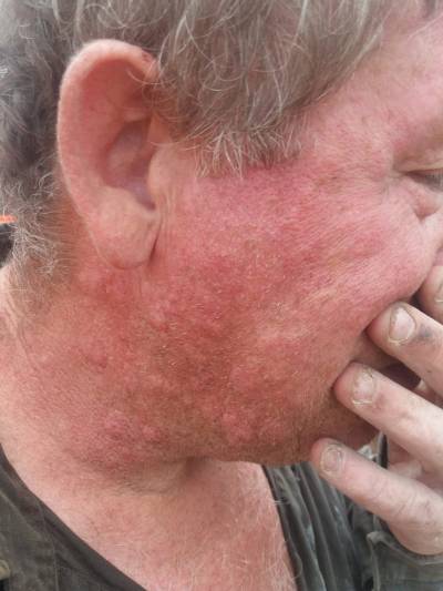 Moncofa recurrirá a Agricultura para declarar plaga la problemática de los mosquitos y dar soluciones ante el abandono de Sanitat