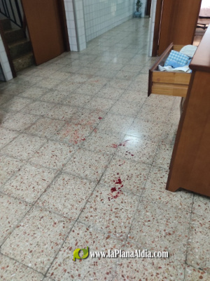 Denuncian una brutal y desproporcionada agresi�n a dos ancianos por robo en Nules