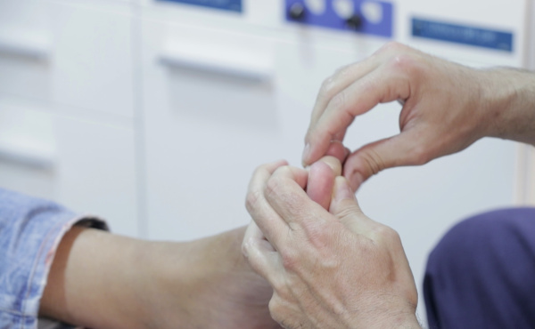 El 47% de los mayores de 75 años padece onicogrifosis, alerta el ICOPCV